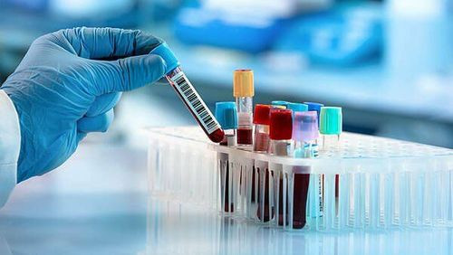 Bác sĩ đánh giá chỉ số máu qua xét nghiệm để ước tính lượng máu trong cơ thể