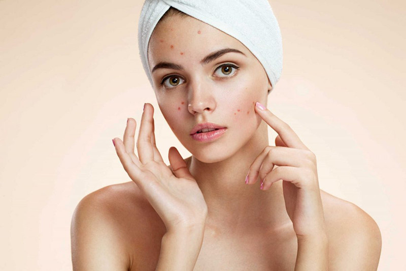 Duy trì đủ nước giúp làn da căng bóng, khỏe mạnh theo công thức tính lượng nước cần uống mỗi ngày