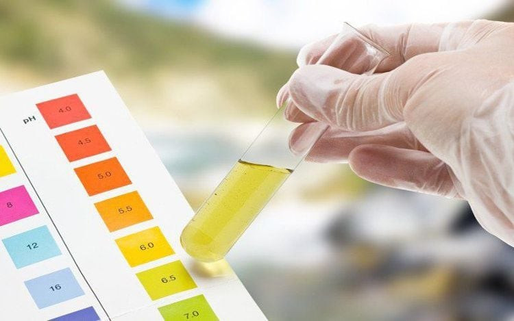 Xét nghiệm độ thẩm thấu máu là việc làm cần thiết trong việc chẩn đoán hạ natri máu